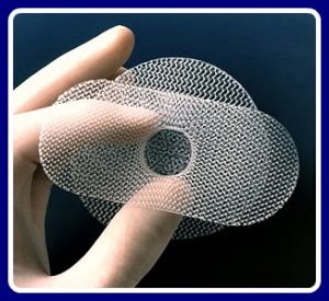Jury Awards $3.35M in Transvaginal Mesh (TVM) Case