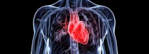 An image showing a scan of a person with an IVC filter
